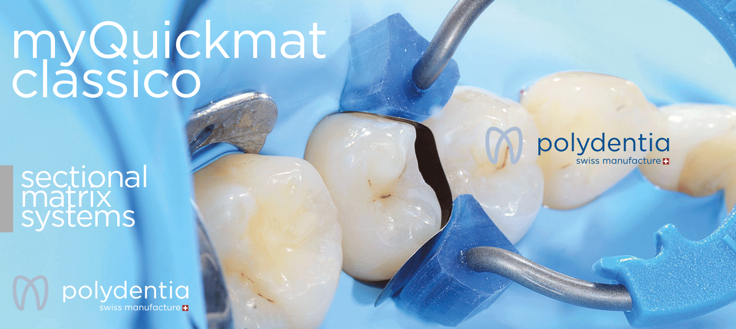 myQuickmat Classico sectional matrix system - restorative dentistry